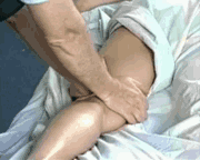 Spreading fascia
