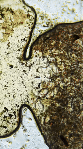 V5 Parasite Formula vs Parasites