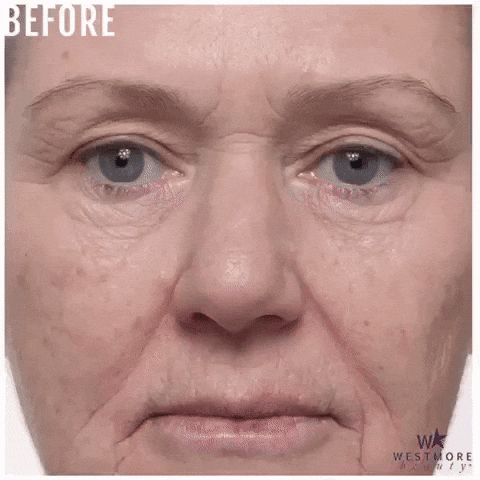 Before And After Anti Aging GIF by Westmore Beauty