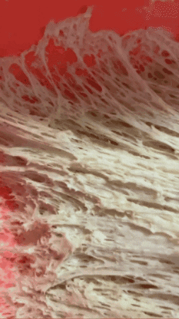 Starter Is Rising But Not Doubling GIF