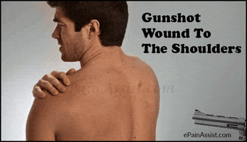 gunshot wound to the shoulders GIF by ePainAssist