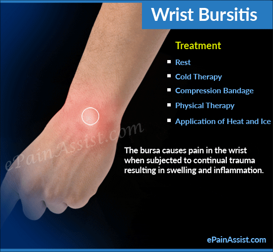 wrist bursitis GIF by ePainAssist