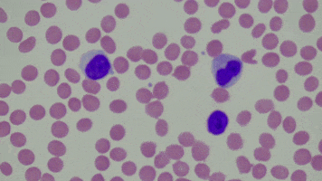 Blood Cancer GIF by Ansel Oommen