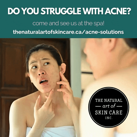GIF by The Natural art of Skin Care