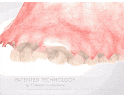 GuidedSMILE GIF