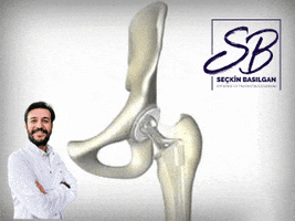 drseckinbasilgan orthopedics ortopedi seckin hip replacement GIF