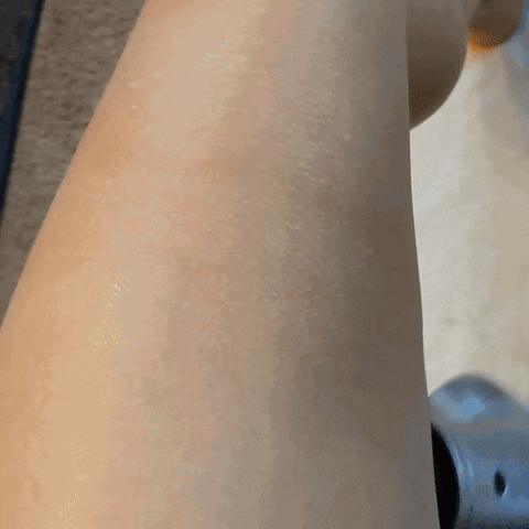 Recovery GIF