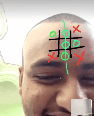 Forehead Gms GIF