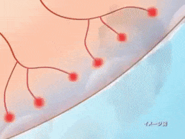 Jock Itch Relief GIF