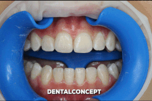 davidantoniovilcaobregon dentalconcept GIF