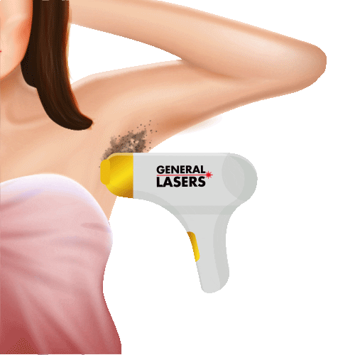 General Lasers Sticker