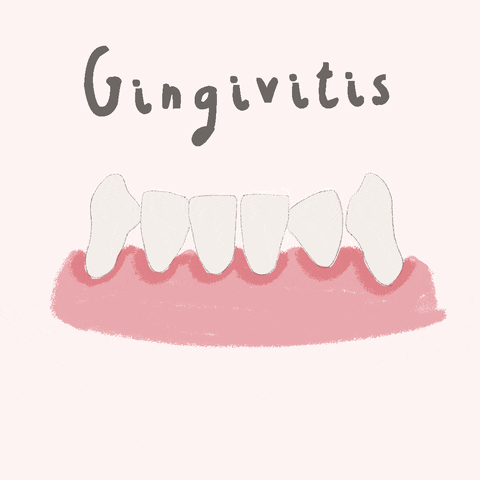 dentistdoodles perio periodoncia gingivitis periodontitis GIF