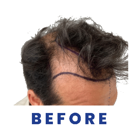 Hair Restoration Center Sticker