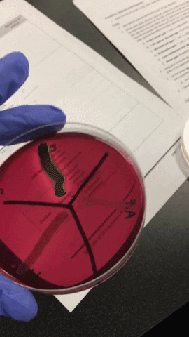 E-Coli GIF