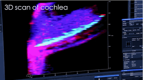 3d scan of cochlea