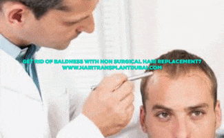 Hair Replacement GIF