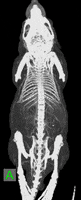 Ct Xray GIF by TriFoil Imaging