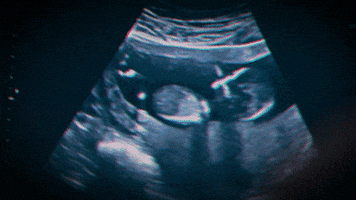 sonogram GIF by The Leftovers HBO