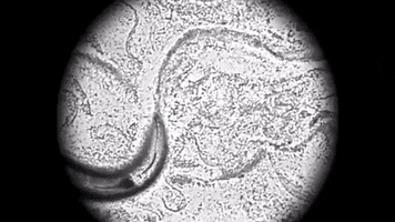 Worm Biology GIF by MIT