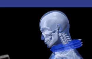Neck Pain GIF