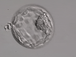 Blastocyst GIF