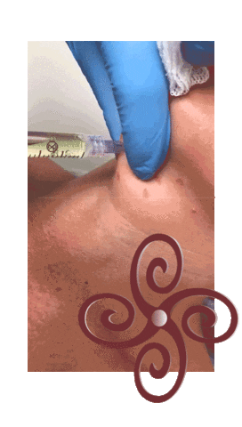 Odontologia Botox Sticker by Instituto Cíntia Vale