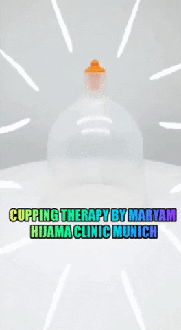 hijama cupping hijama cuppingtherapy schröpfen GIF