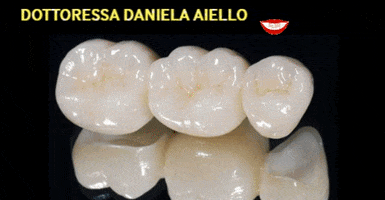aiello 1 teeth italia dentist GIF
