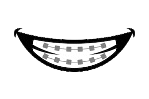 Braces Sticker by Foley Orthodontics