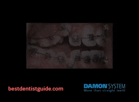 Damonbraces GIF