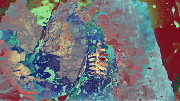 200.gif?cid=fc005b087da8a86525f247ed37e075a54c433b0e1a58ed24&rid=200.gif&ct=g