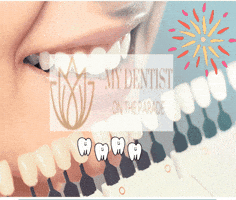 Dental Implants Adelaide GIF