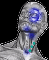 Muscle Pain GIF by Luxxamed GmbH