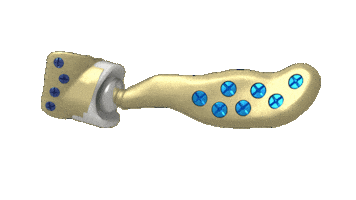 Sticker by Materialise Brasil