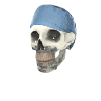 KLSMartinGroup skull surgery implants kls Sticker