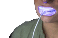 Hismile Whitening Sticker by Coco Glam