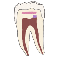 Pulp Endodoncia Sticker