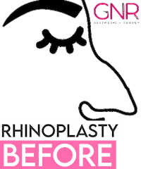 Bbl Breast Sticker by GNR Esthetics