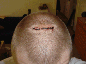 head healing GIF