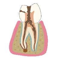 Endodoncia Endodontics Sticker