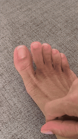 GIF Tratamiento Láser