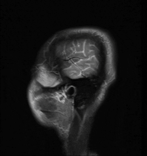 RedefineTheObvious giphyupload skull head brain GIF