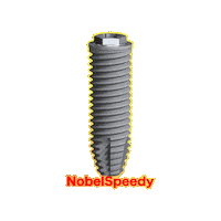 All-On-4 Implant Sticker by takashiuchida