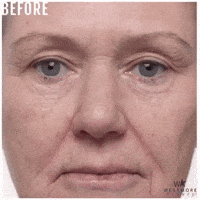 Before And After Anti Aging GIF by Westmore Beauty