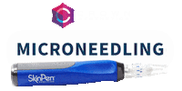 Acne Scars Sticker by Crown Aesthetics