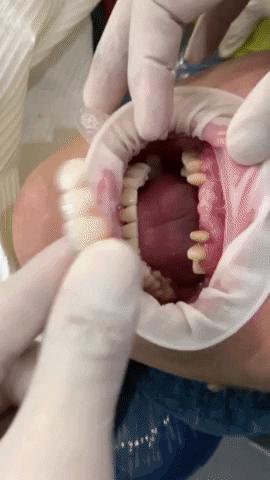 apostoldental giphygifmaker smile teeth dentistry GIF