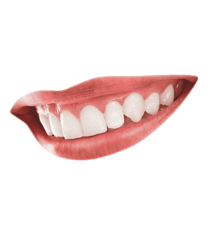 RaizMarketing giphyupload dentista sorriso boca Sticker