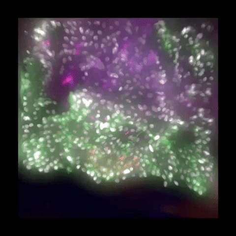 LeicaMicrosystems giphygifmaker microscope haze microscopy GIF
