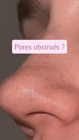 Mimley giphyupload GIF