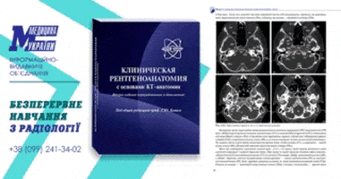 urctmrt giphyupload GIF